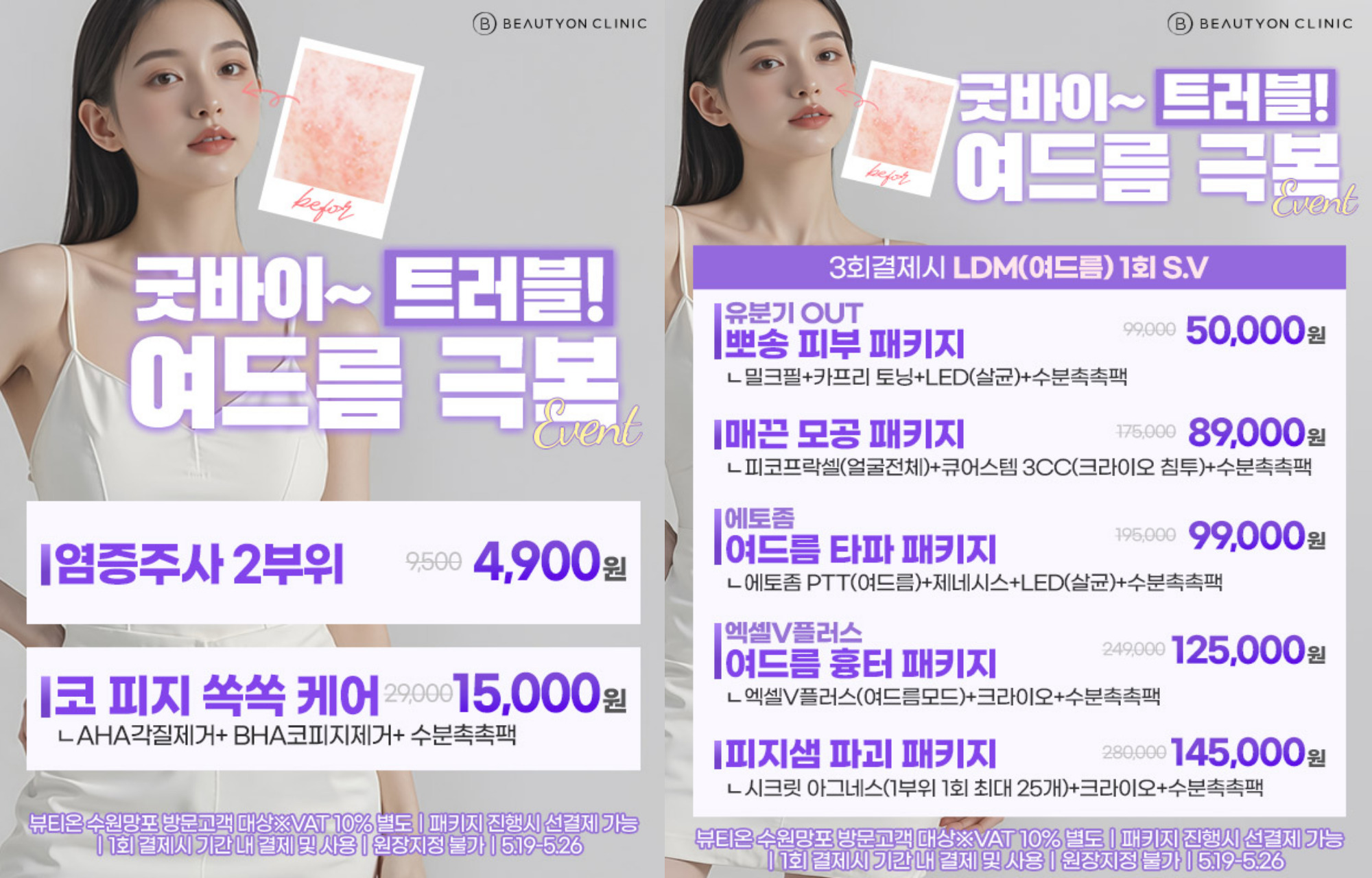 팝업이미지