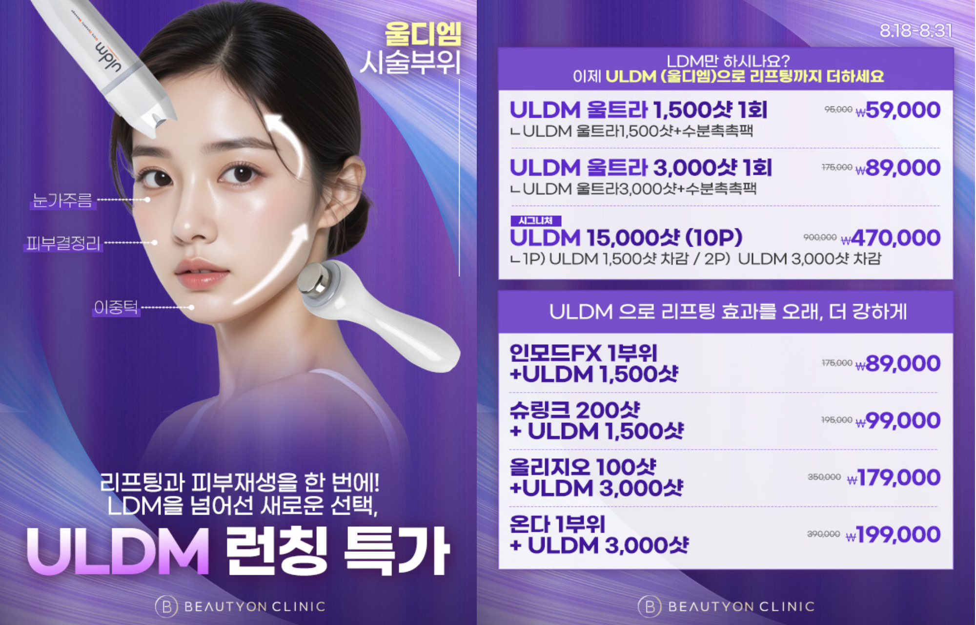 팝업이미지