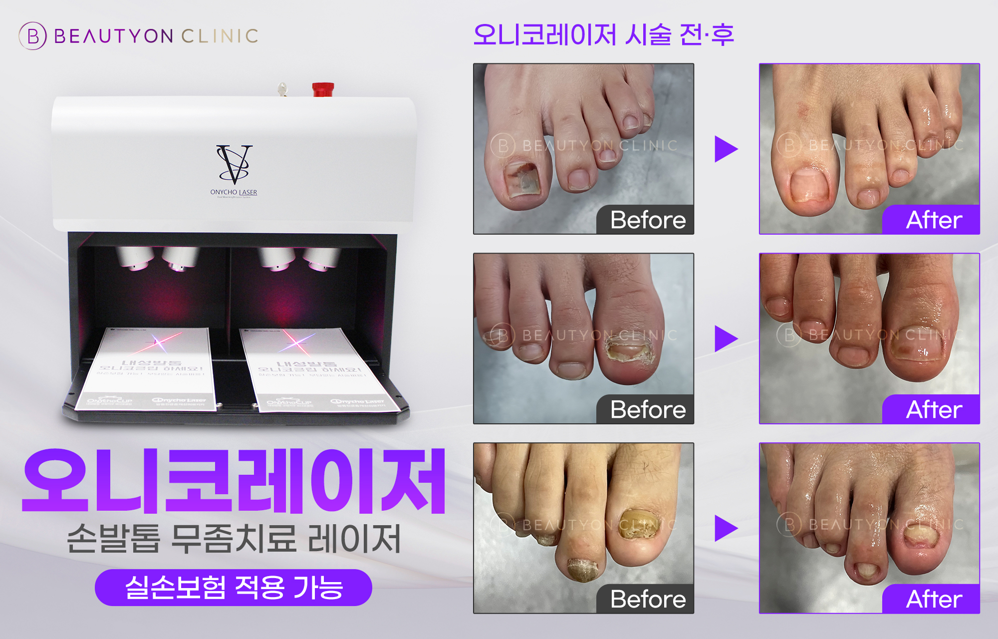팝업이미지
