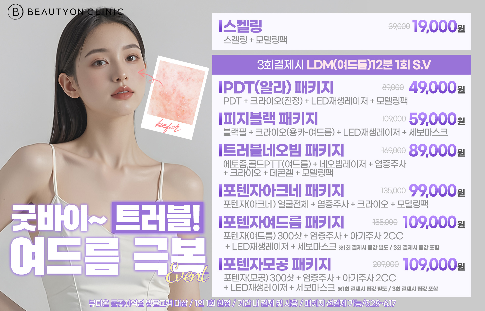 팝업이미지
