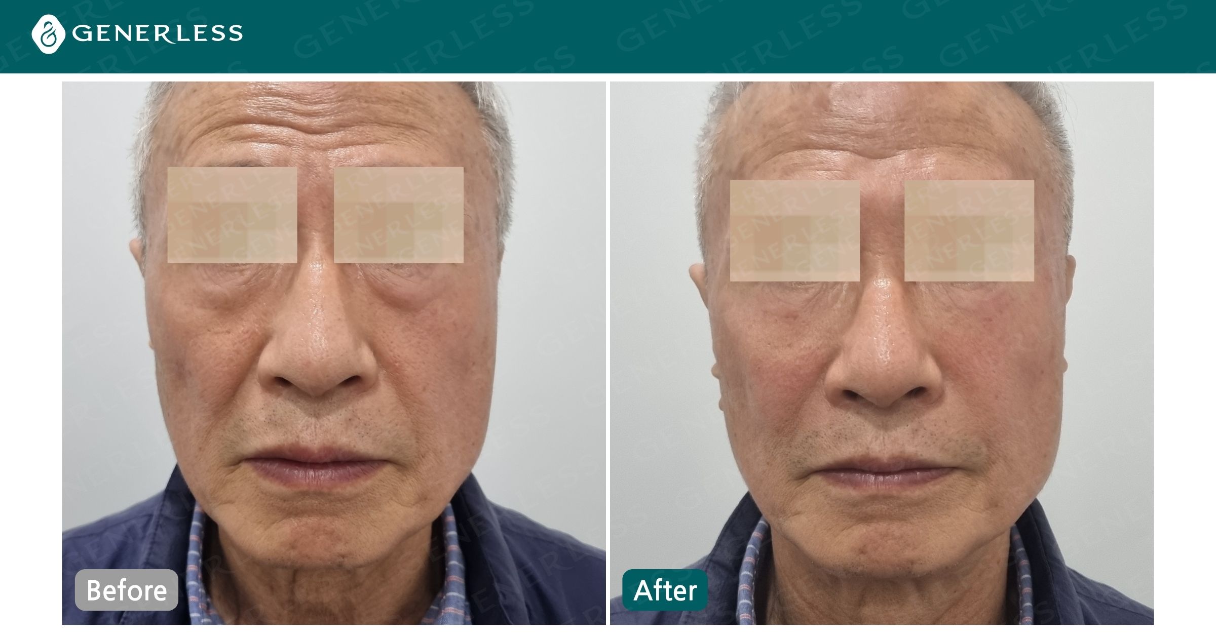 박스 슬라이드 이미지