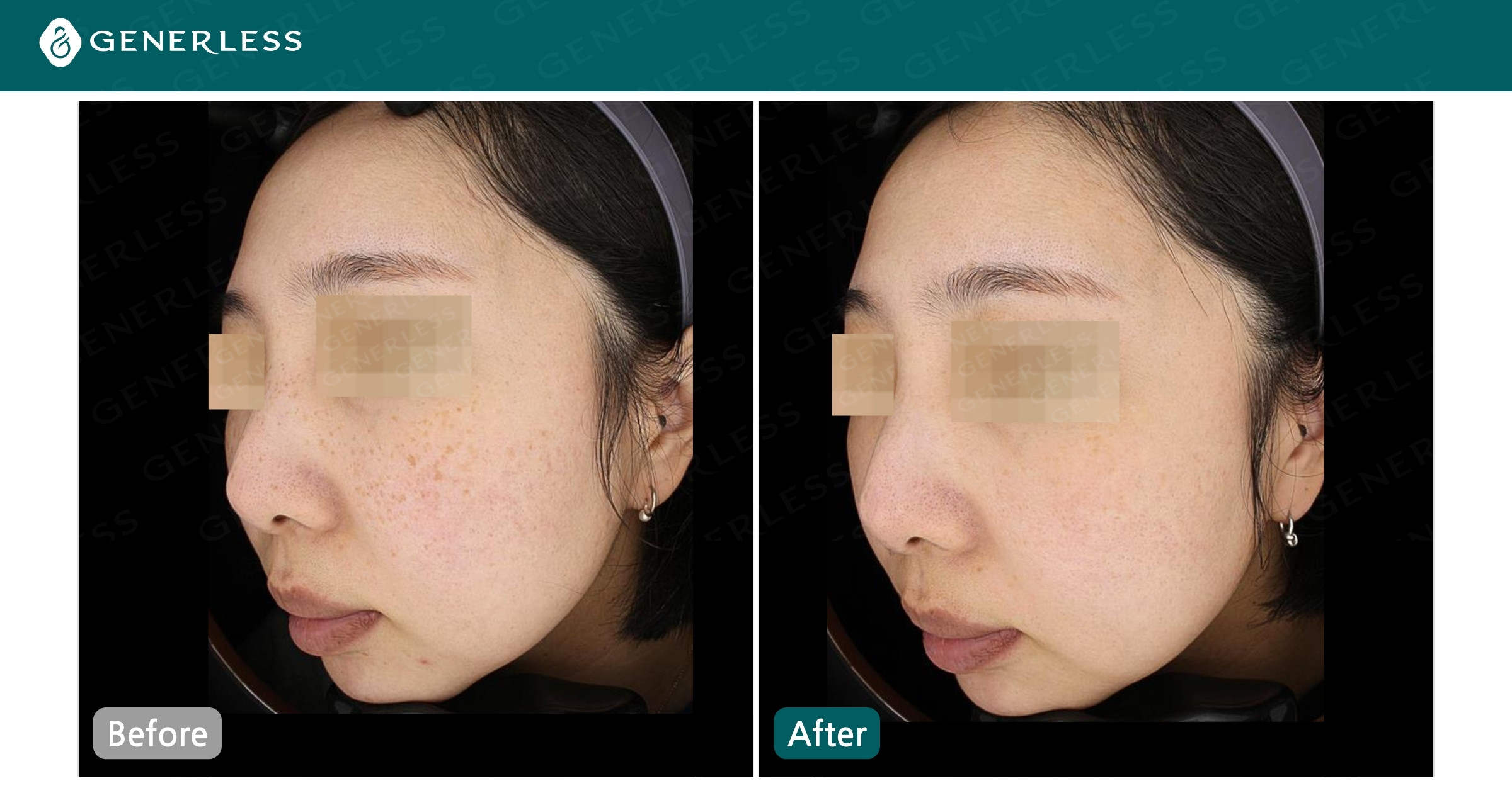 박스 슬라이드 이미지