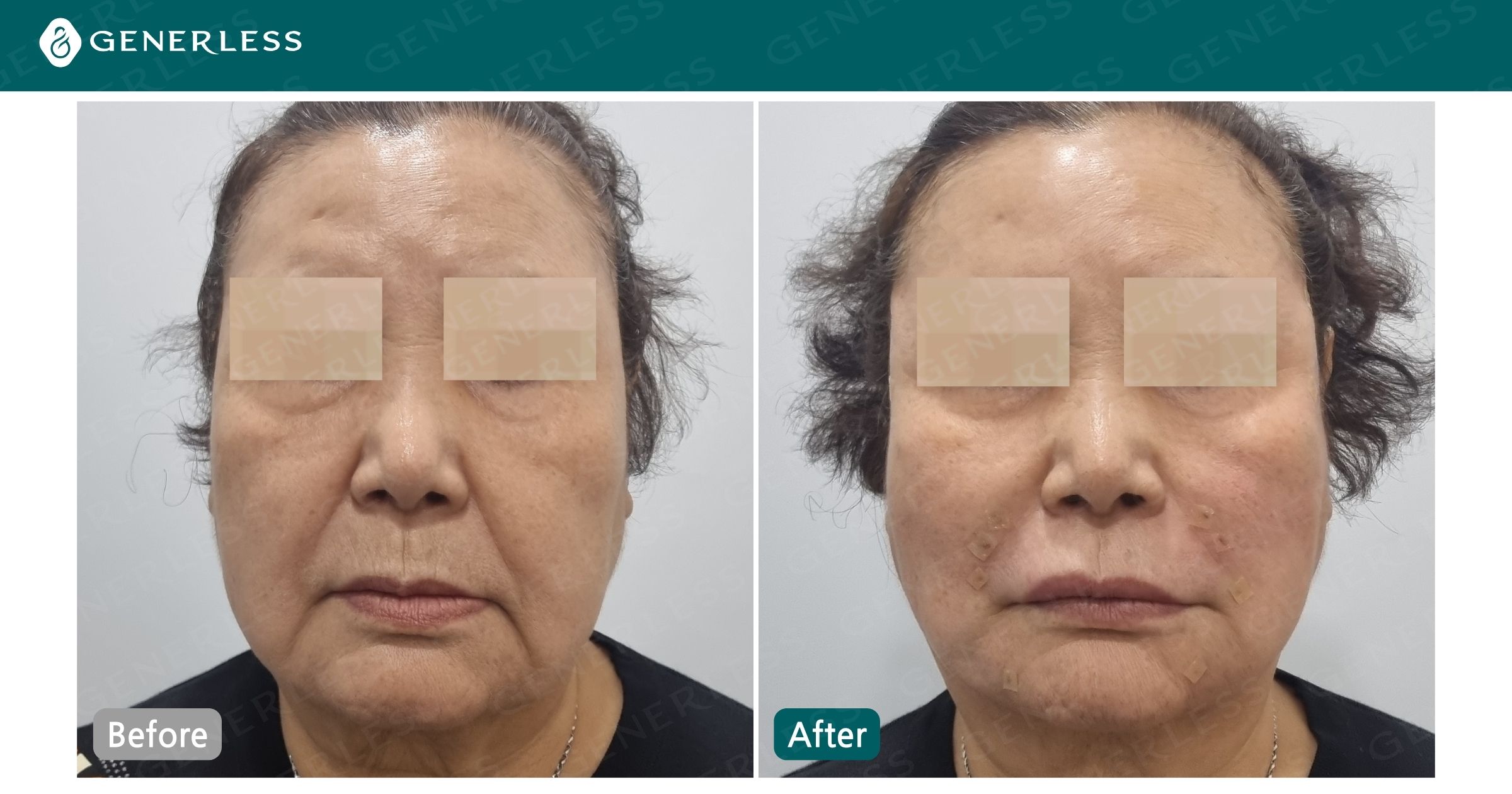 박스 슬라이드 이미지