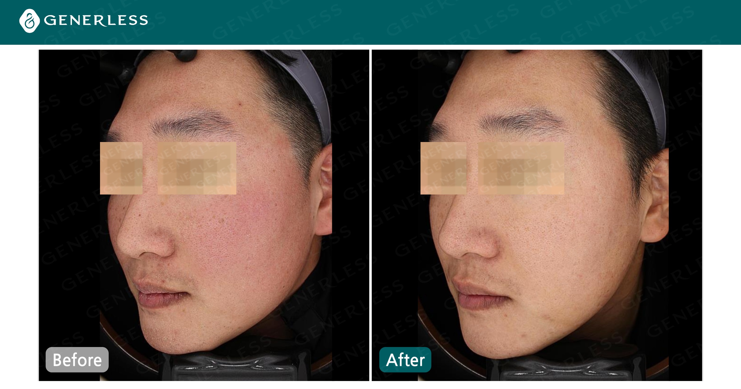 박스 슬라이드 이미지