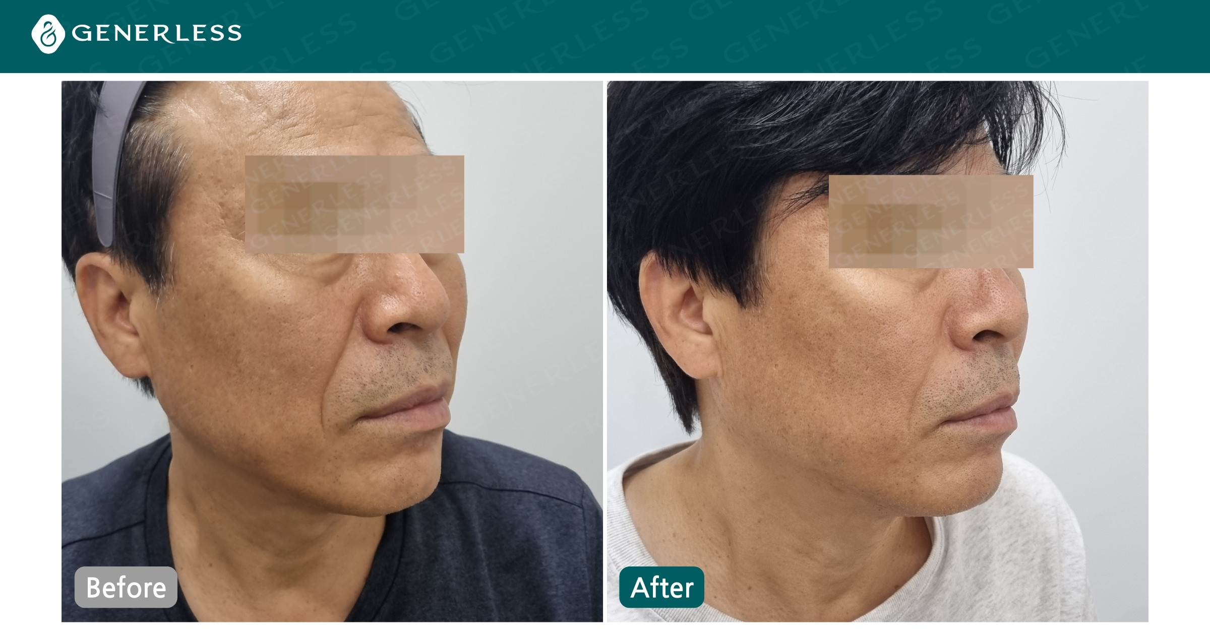 박스 슬라이드 이미지