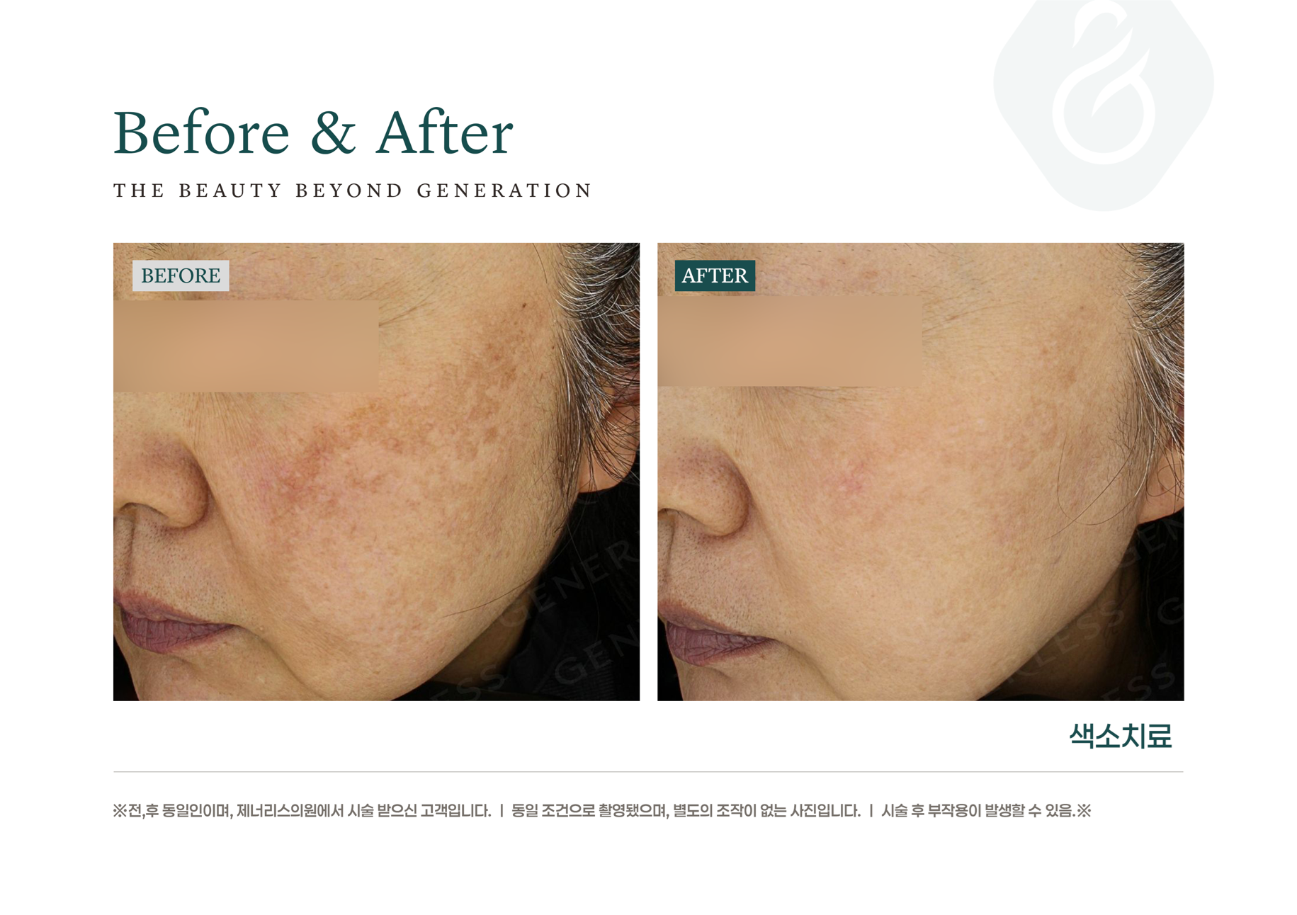 카드 슬라이드 이미지