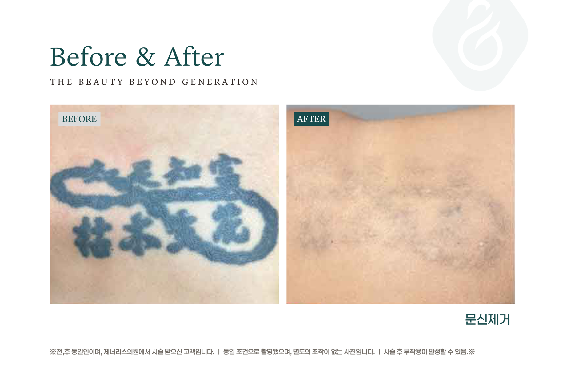 카드 슬라이드 이미지