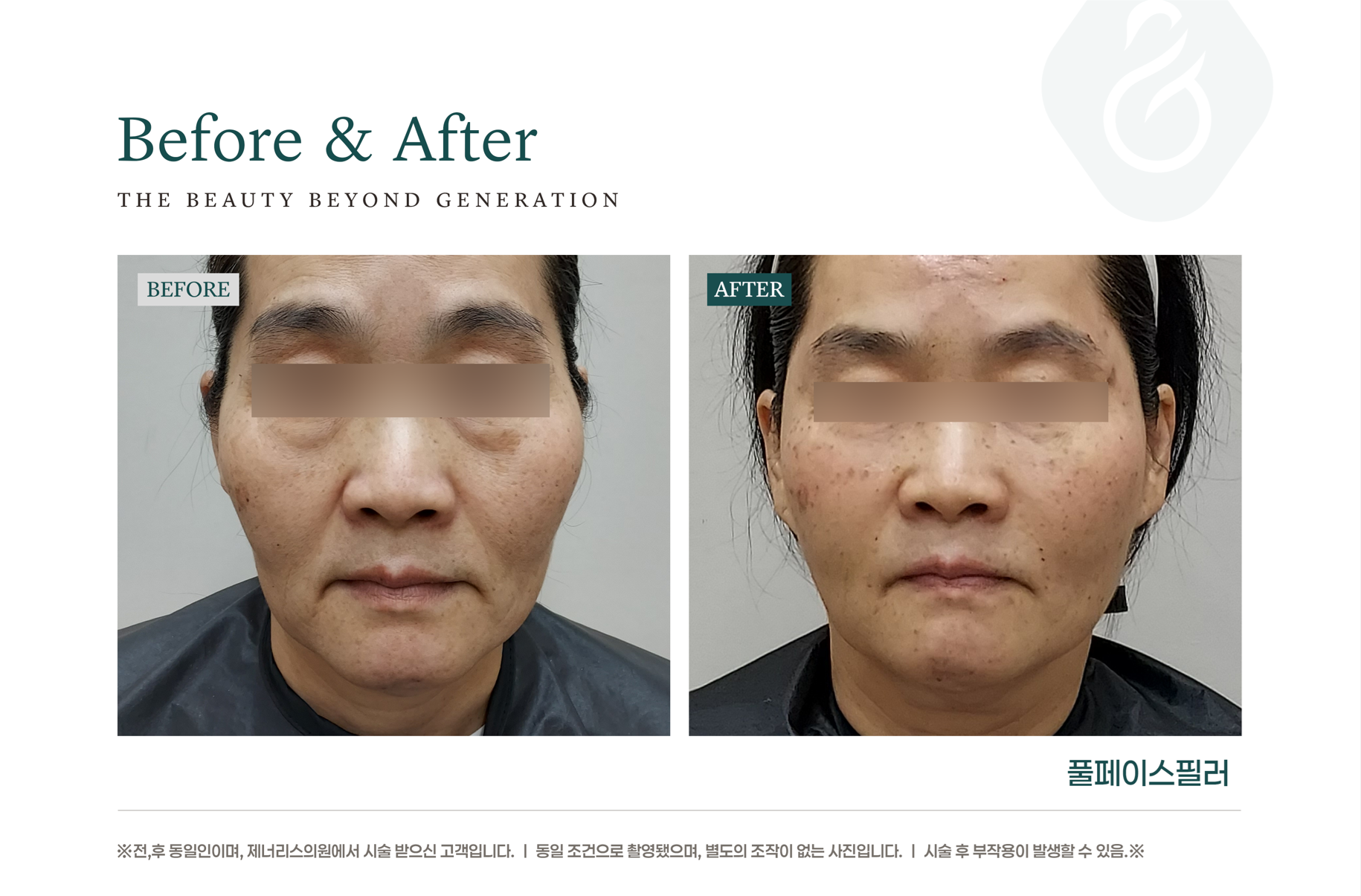 카드 슬라이드 이미지