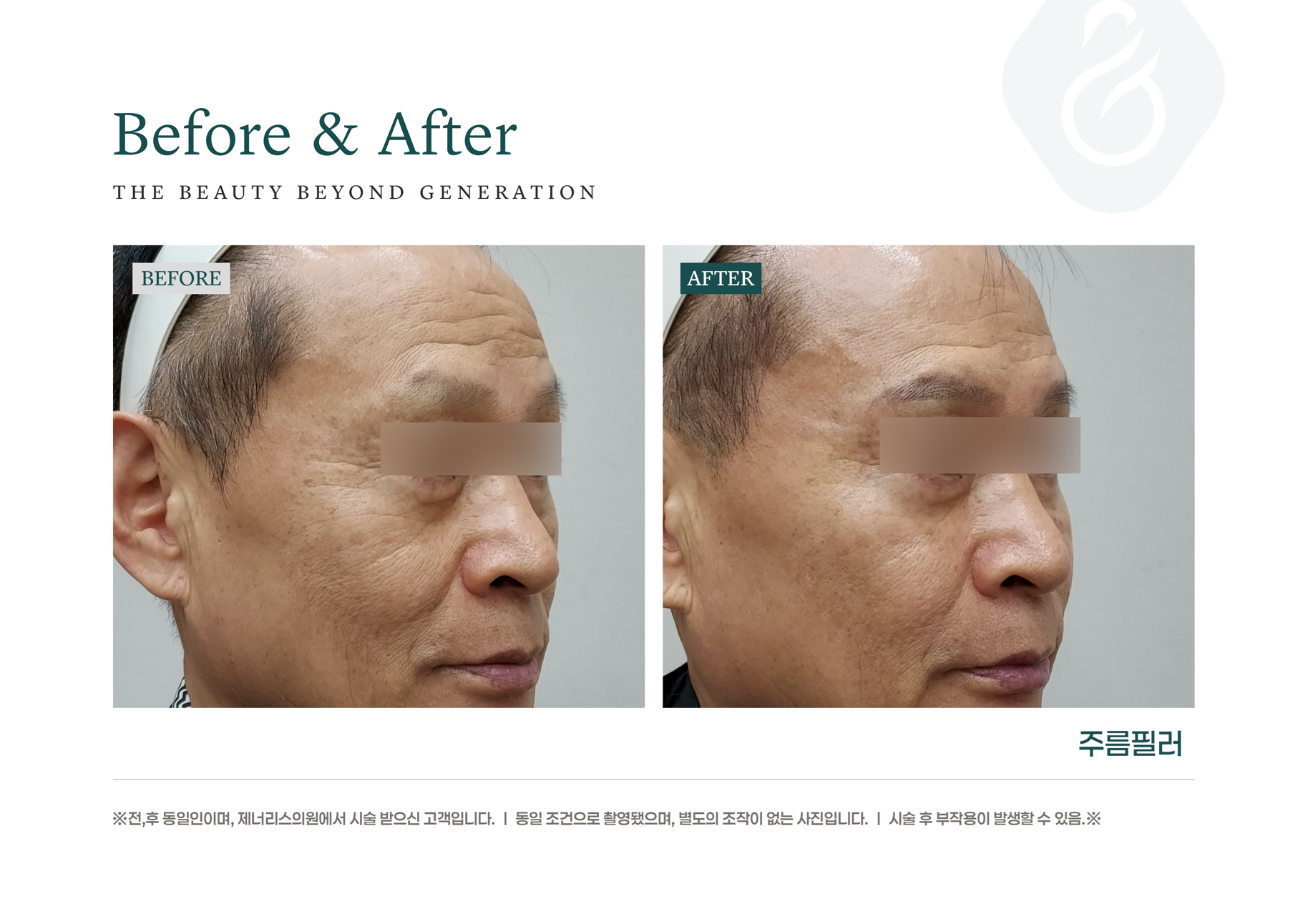 카드 슬라이드 이미지