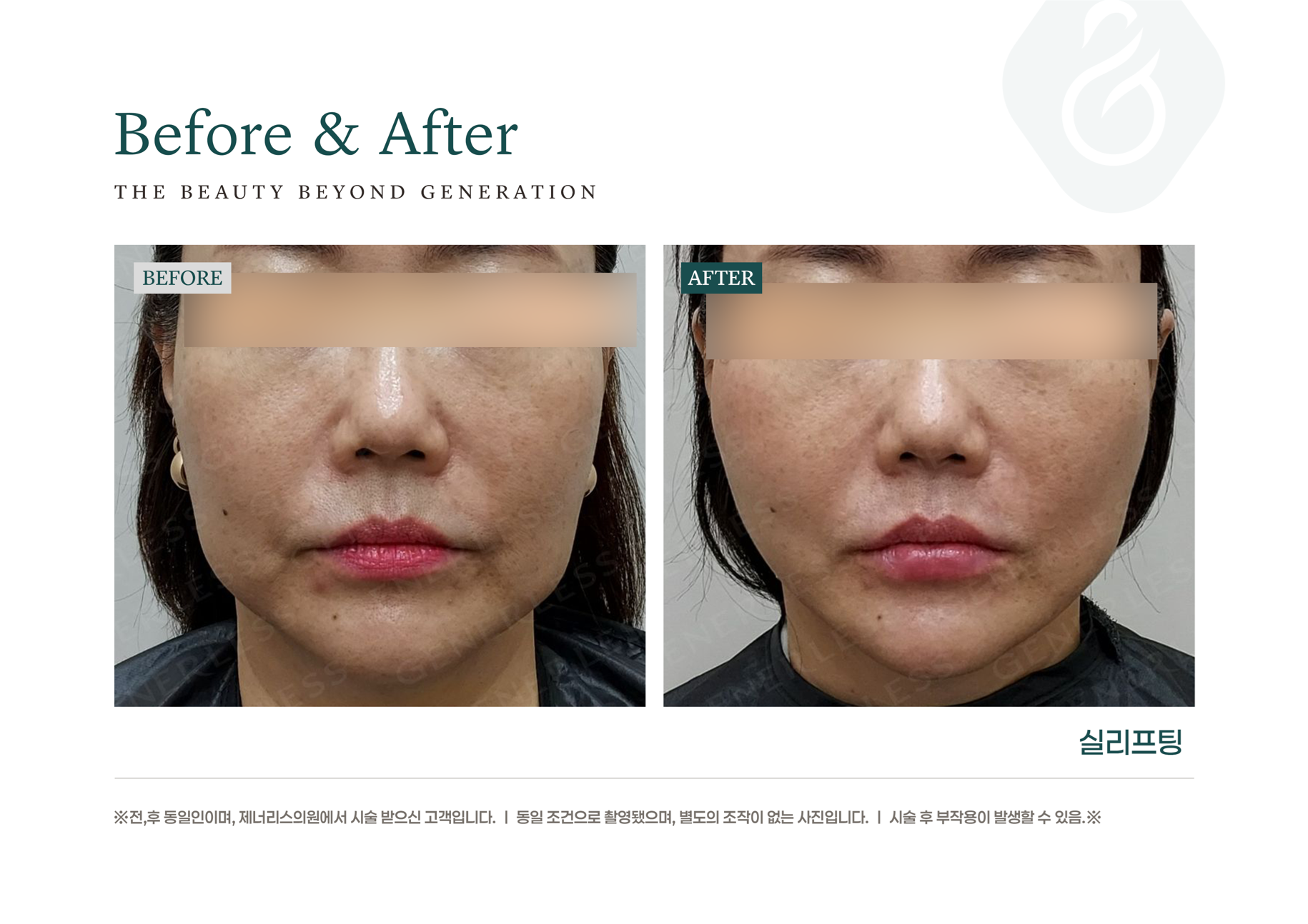 카드 슬라이드 이미지