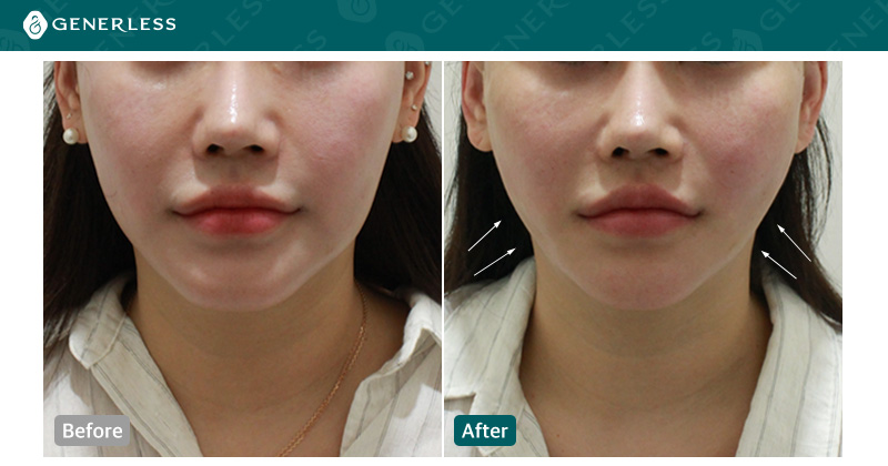 박스 슬라이드 이미지