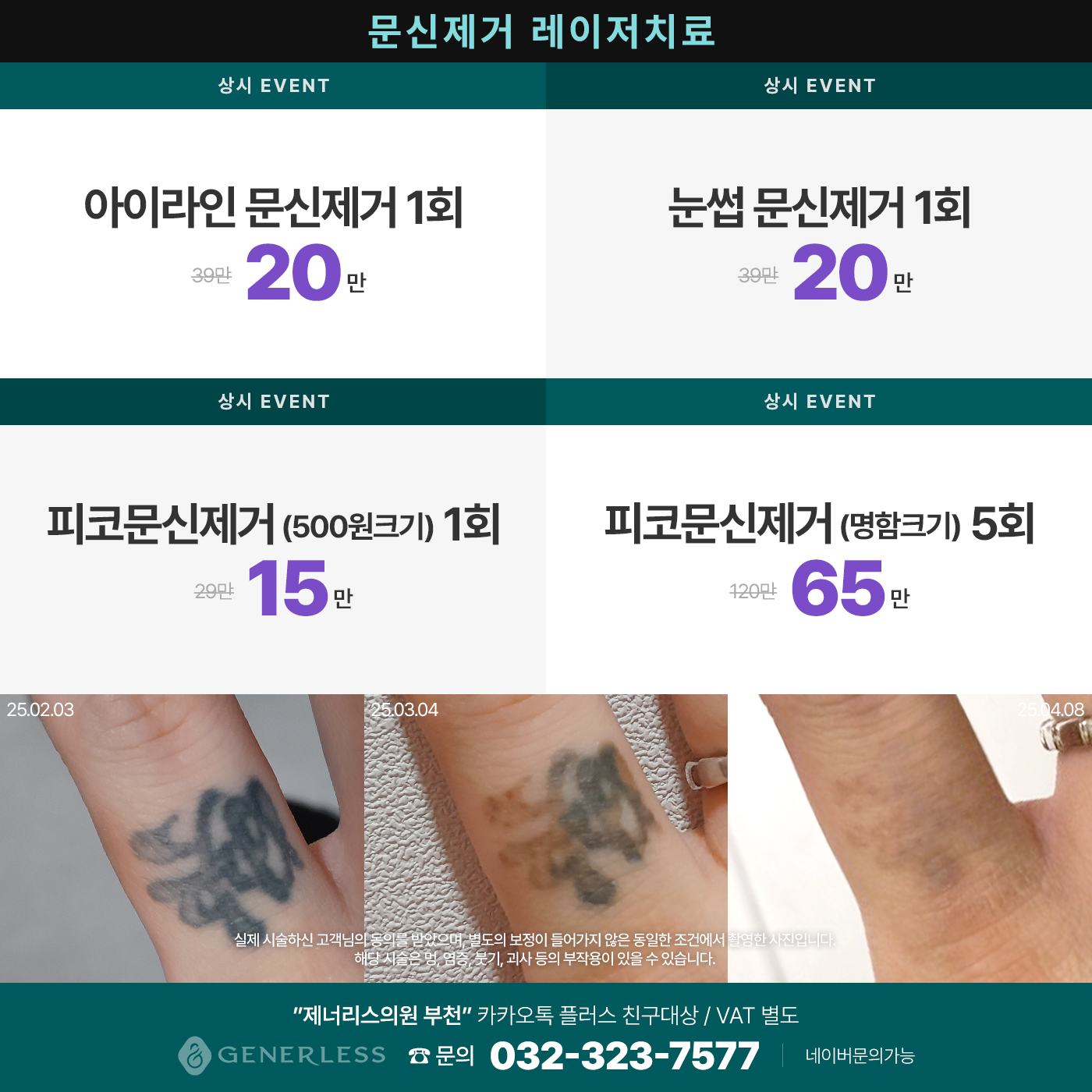 팝업이미지