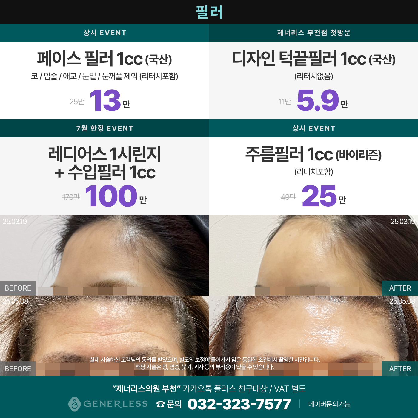 팝업이미지