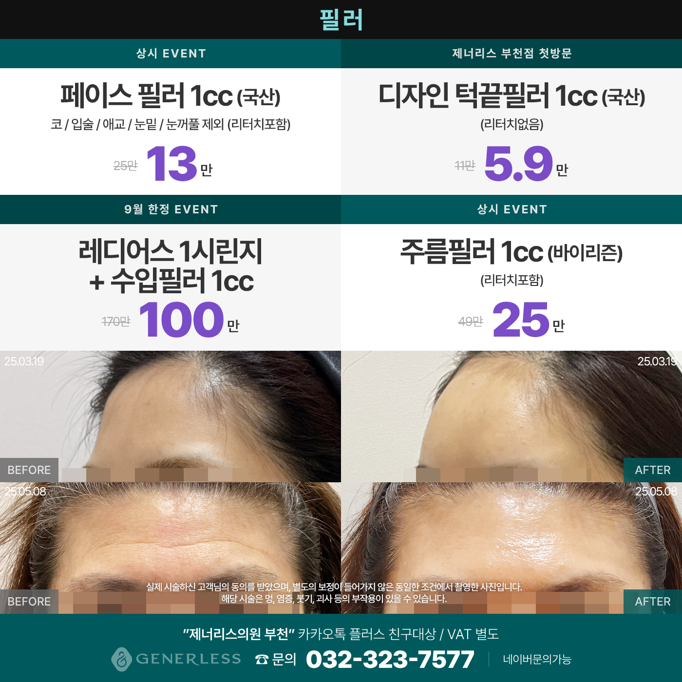 팝업이미지