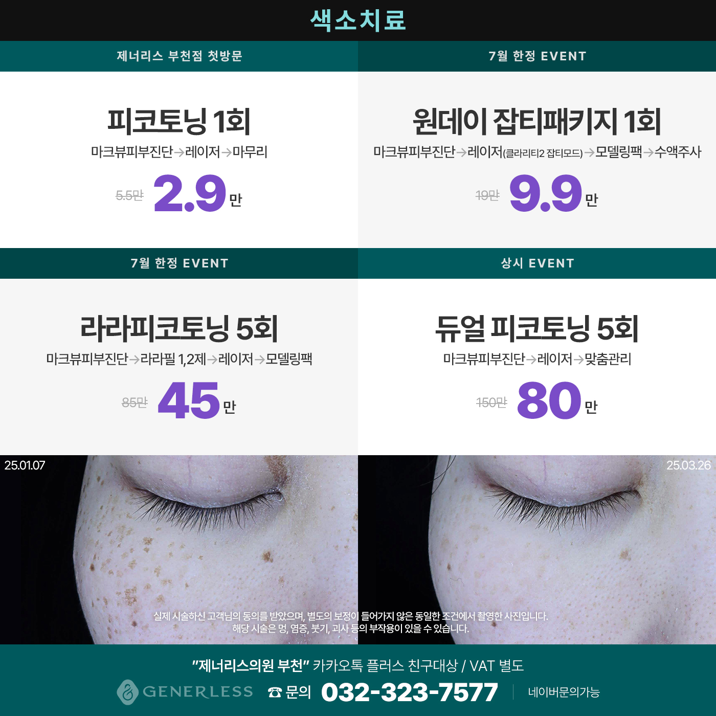 팝업이미지