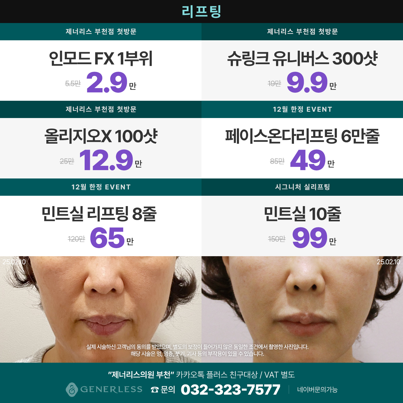 팝업이미지