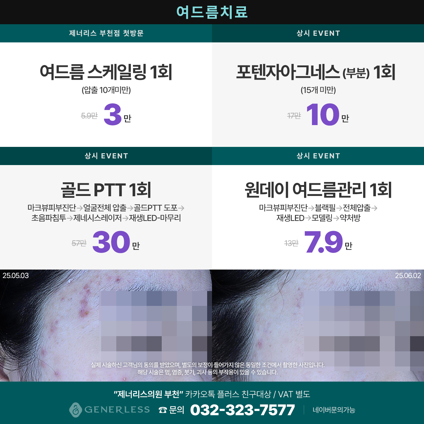 팝업이미지
