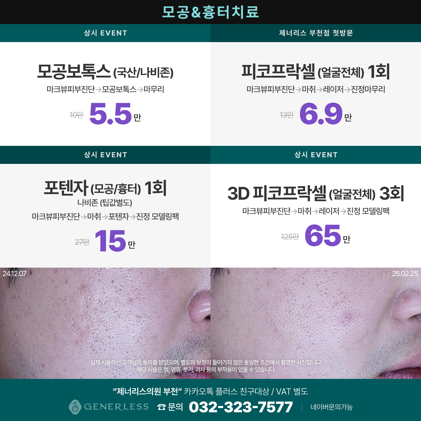팝업이미지