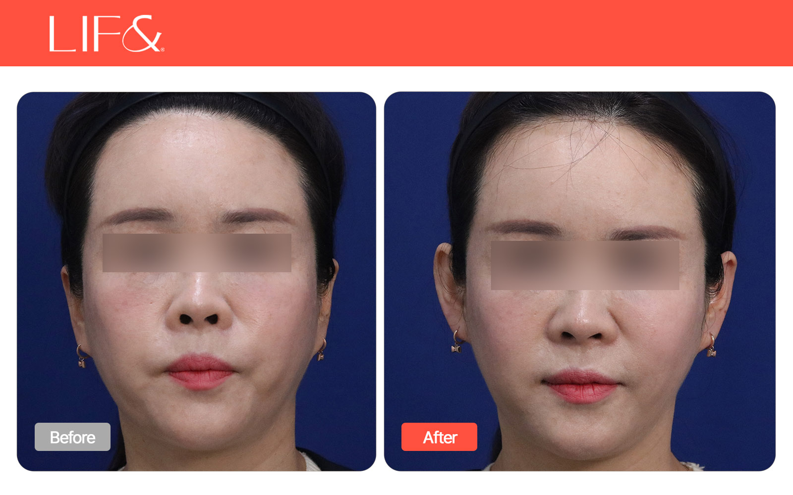 박스 슬라이드 이미지