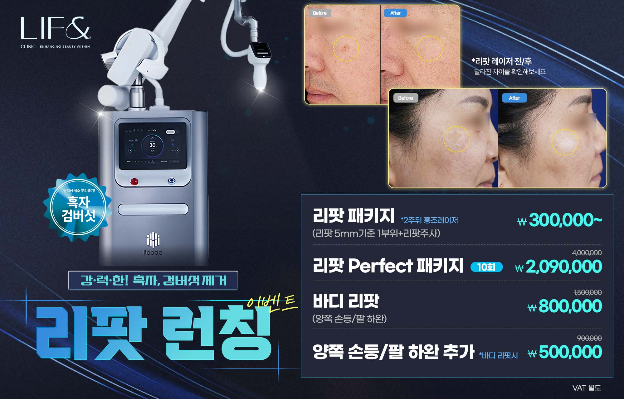 팝업이미지