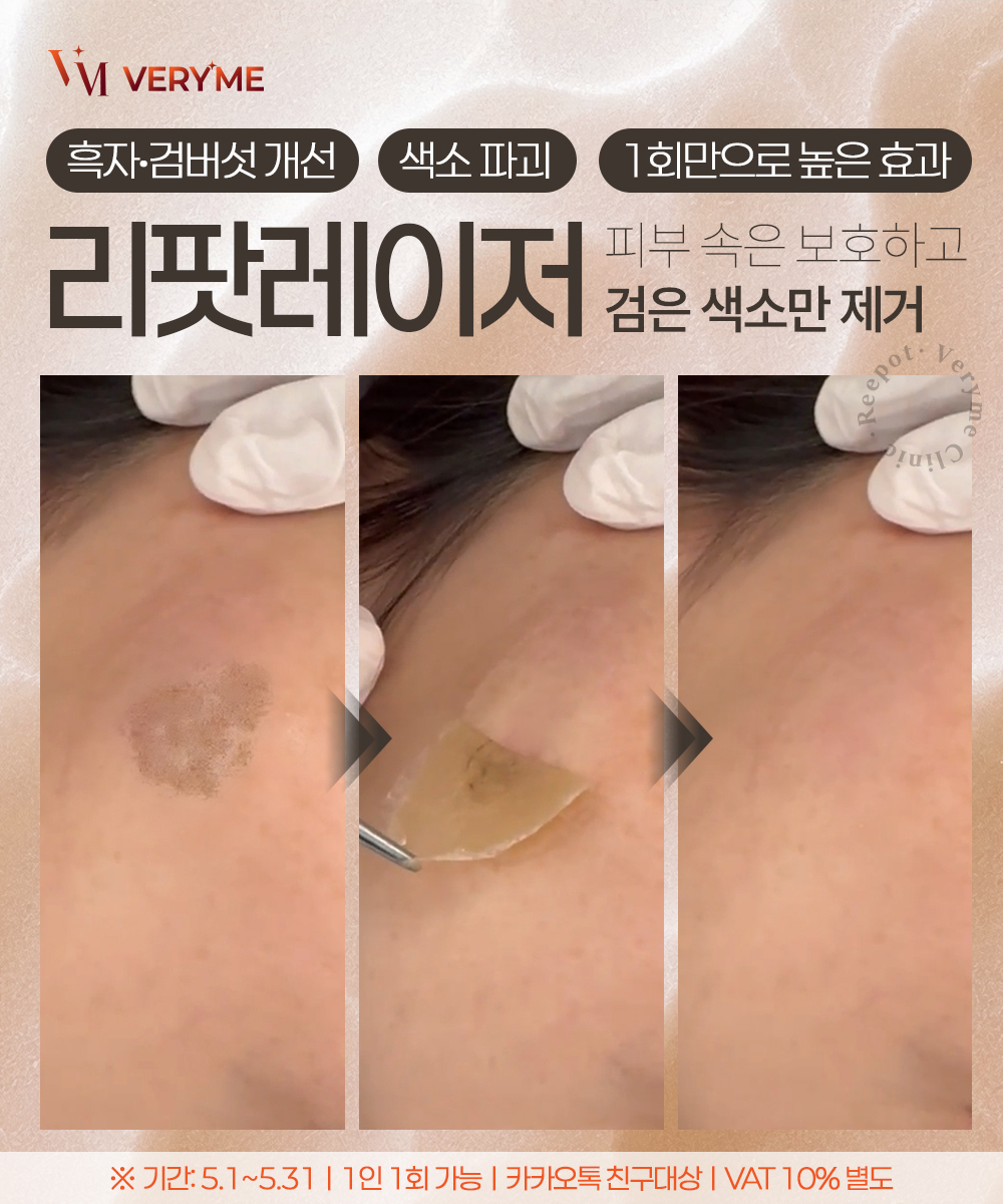 팝업이미지